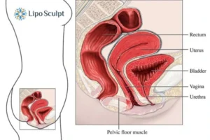 Treatment For A Leaky Bladder 2 How EM Chair treatment Portsmouth can help Leaky bladder issues. Read more now!