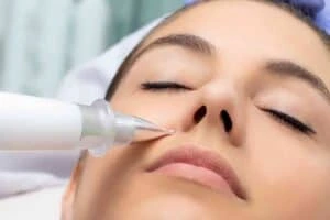 Best Actinic Keratoses Removal 3 Actinic keratoses Portsmouth solutions - book in today!